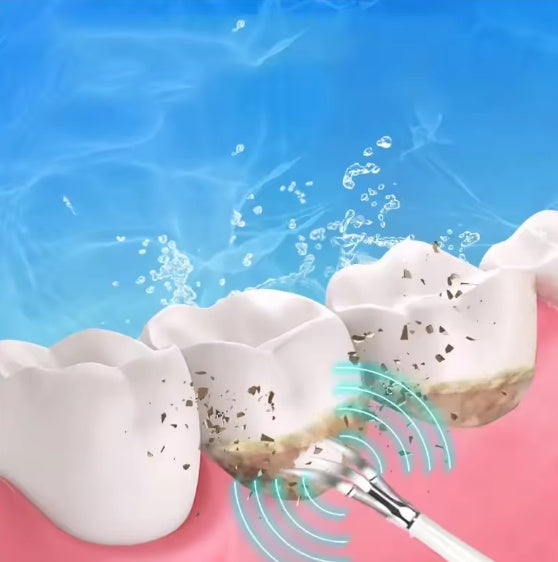 Smart Ultra-Sonic Teeth Cleaner
