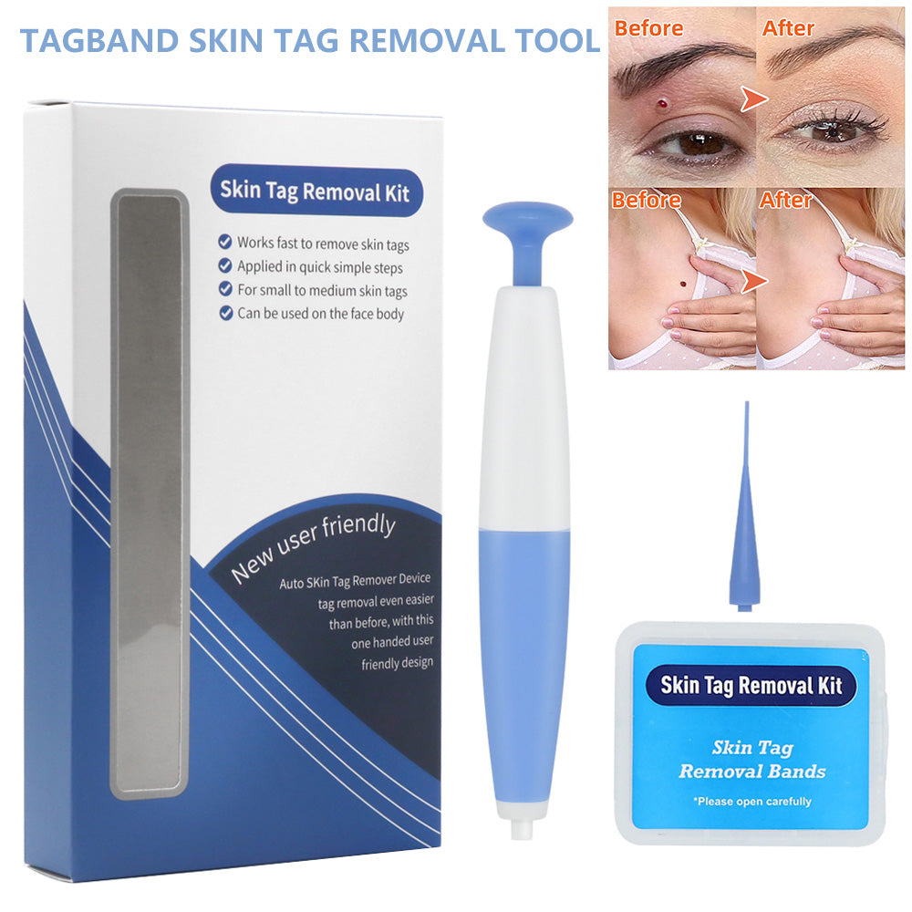 Skin Tag Removal Kit – Home Use Mole & Wart Remover Tool, Easy Clean Micro Band Skin Care Device