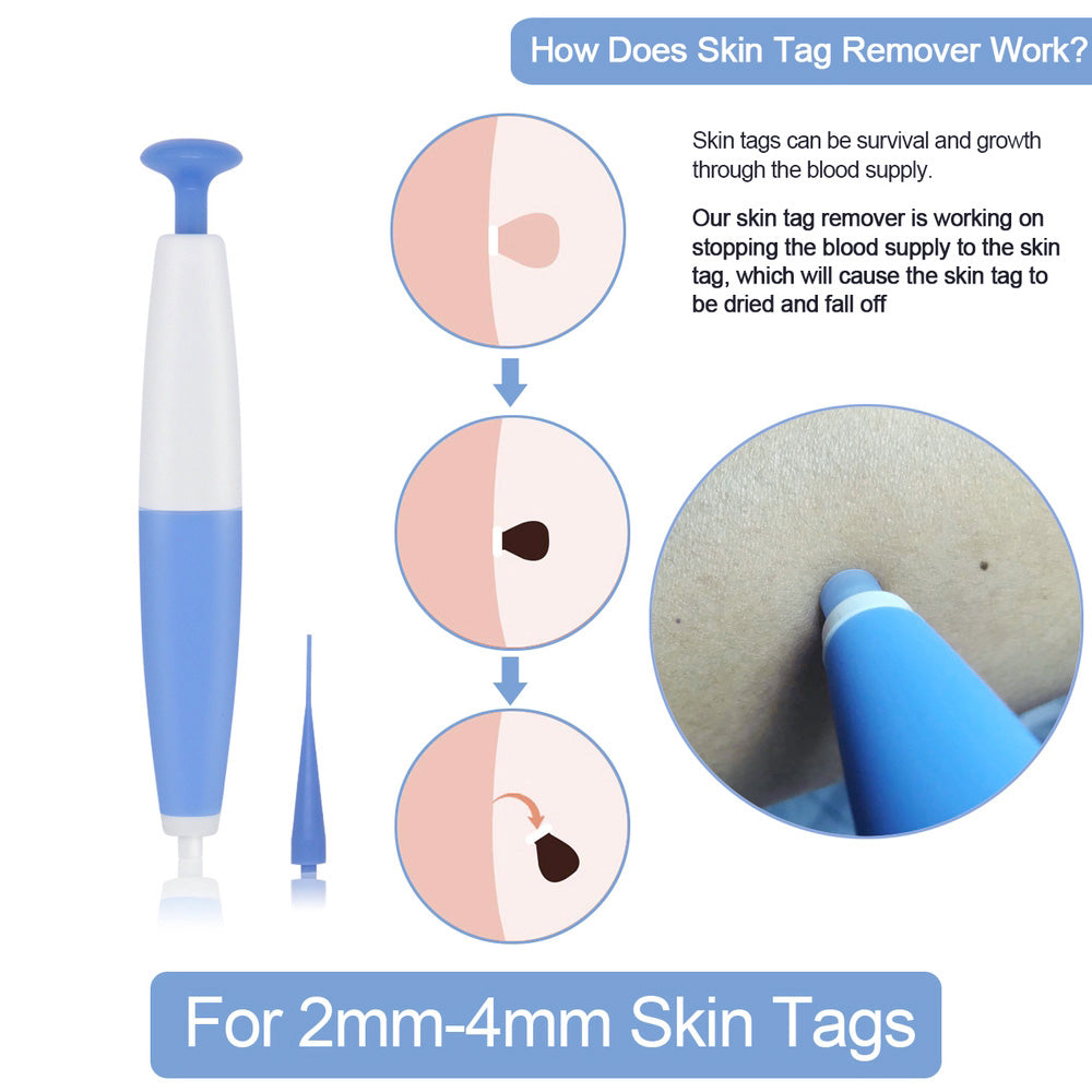 Skin Tag Removal Kit – Home Use Mole & Wart Remover Tool, Easy Clean Micro Band Skin Care Device