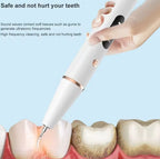 Smart Ultra-Sonic Teeth Cleaner